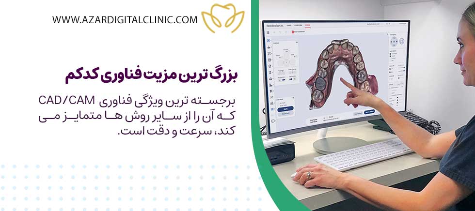 مزایای استفاده از فناوری کدکم | کلینیک دندانپزشکی دیجیتال آذر
