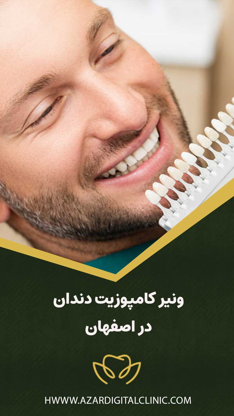 کامپوزیت دندان در اصفهان | کلینیک دندانپزشکی دیجیتال آذر