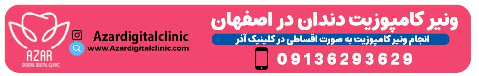 تماس با کلینیک دندانپزشکی آذر | مرکز کامپوزیت دندان در اصفهان