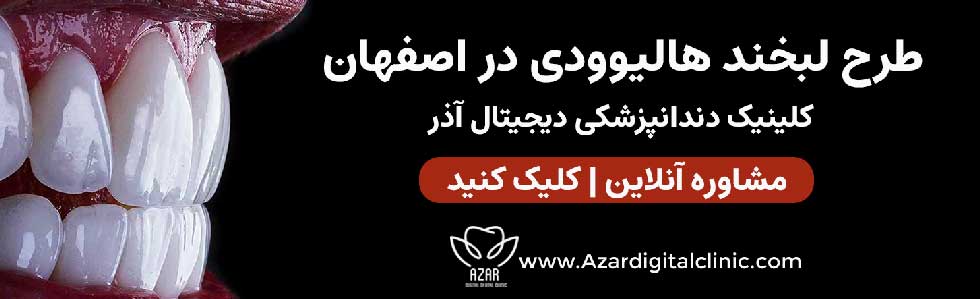 تماس با ما | مرکز لبخند هالیوودی آذر در اصفهان