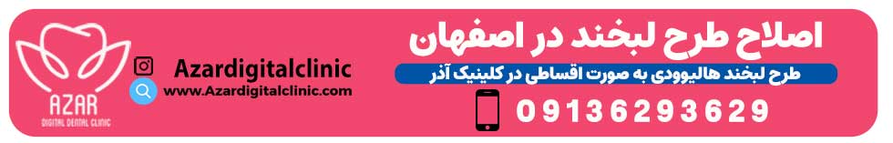 تماس با ما | کلینیک دندانپزشکی دیجیتال آذر در اصفهان