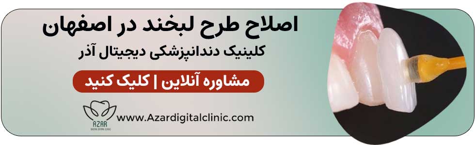 تماس با کلینیک اصلاح لبخند آذر در اصفهان | کلینیک دندانپزشکی دیجیتال آذر در اصفهان اصفهان 