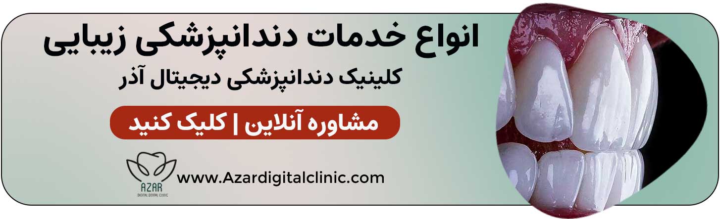 دندانپزشکی زیبایی در اصفهان | مرکز زیبایی آذر اصفهان