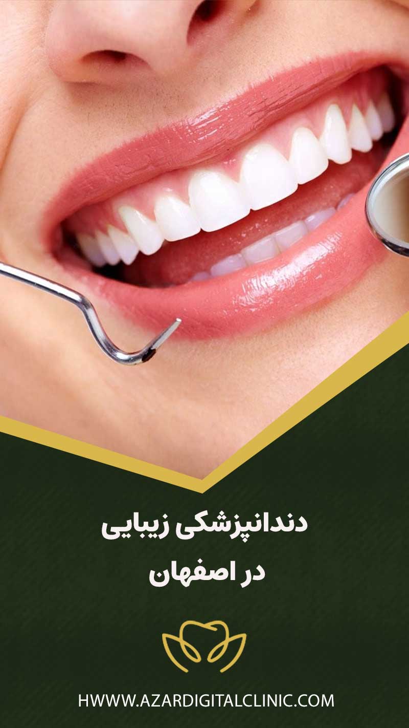 دندانپزشکی زیبایی در اصفهان | کلینیک دندانپزشکی دیجیتال اصفهان