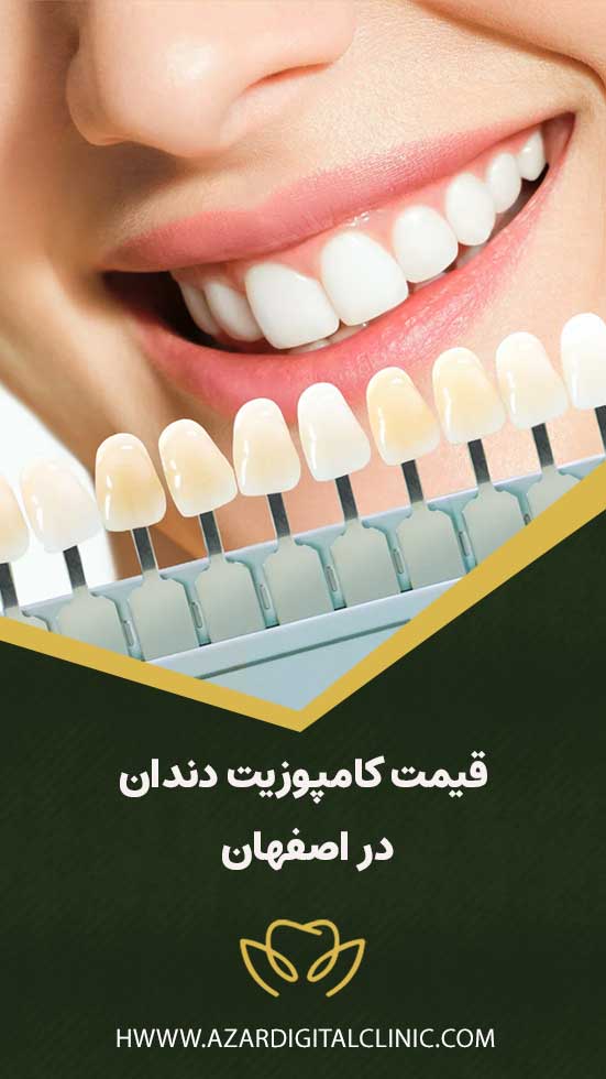 قیمت کامپوزیت دندان در اصفهان | کلینیک دندانپزشکی دیجیتال آذر