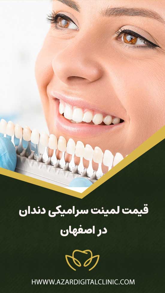 قیمت لمینت سرامیکی دندان در اصفهان | کلینیک دندانپزشکی دیجیتال آذر