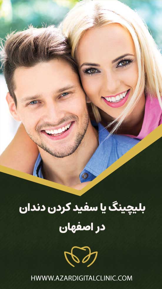 بلیچینگ دندان در اصفهان | کلینیک دندانپزشکی دیجیتال اصفهان