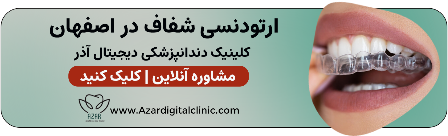 ارتودنسی شفاف و نامرئی در اصفهان 