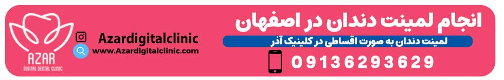 تماس با کلینیک لمینت سرامیکی آذر در اصفهان | کلینیک دندانپزشکی دیجیتال آذر در اصفهان