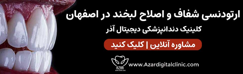 تماس با ما | مرکز ارتودنسی شفاف آذر در اصفهان