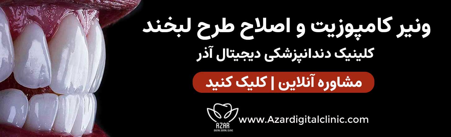 تماس با مرکز زیبایی آذر در اصفهان | ونیر کامپوزیت در اصفهان
