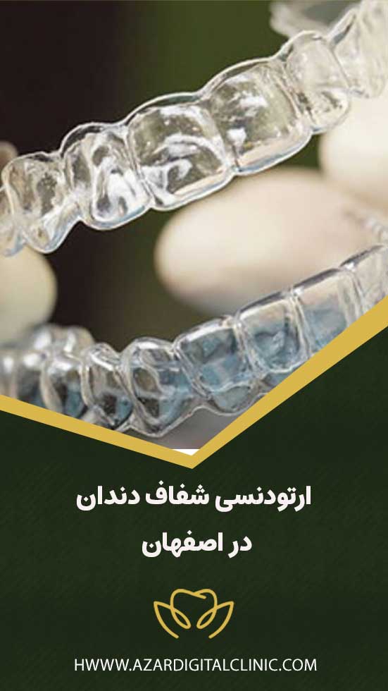 ارتودنسی شفاف در اصفهان | کلینیک دندانپزشکی دیجیتال آذر