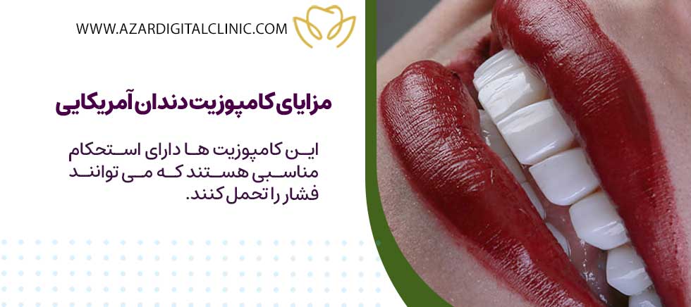 کامپوزیت دندان آمریکایی و مقایسه آن با کامپوزیت دندان سوئیسی
