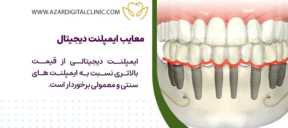 کاشت ایمپلنت دیجیتال اصفهان در کلینیک آذر | معایب ایمپلنت دیجیتال