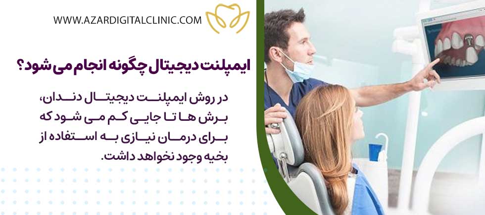 ایمپلنت دیجیتال دندان چگونه انجام می شود؟