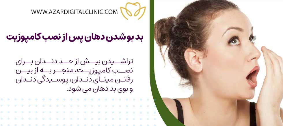 دلایل بد بو شدن دهان پس از نصب کامپوزیت