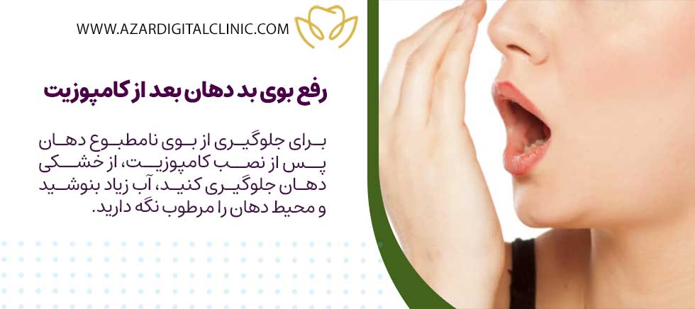 رفع بوی بد دهان بعد از کامپوزیت