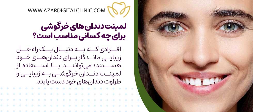 لمینت دندان‌ های خرگوشی برای چه کسانی مناسب است؟