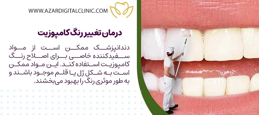 درمان تغییر رنگ کامپوزیت