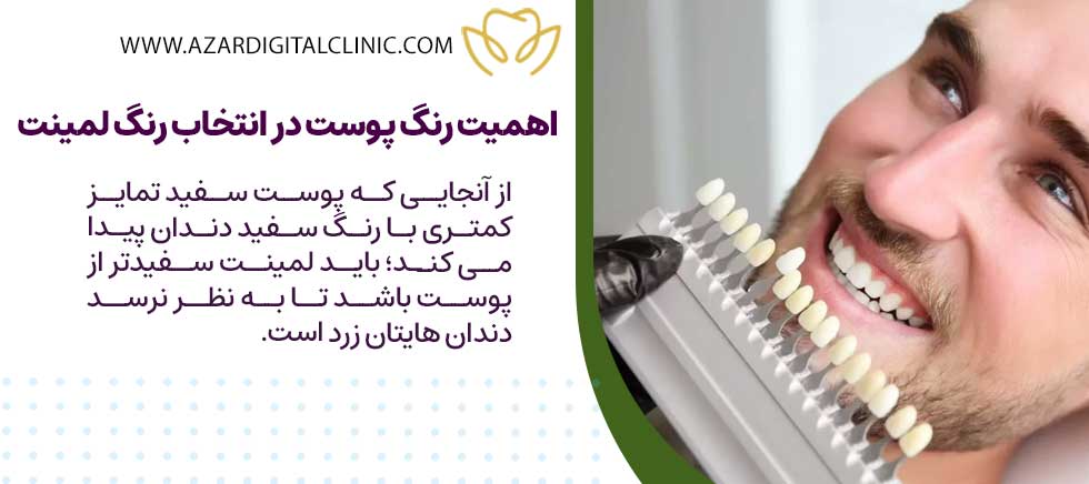 رنگ پوست چه اهمیتی در انتخاب رنگ لمینت دارد؟