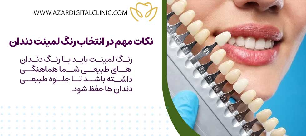 در انتخاب رنگ لمینت دندان، چه نکاتی را باید در نظر بگیریم؟