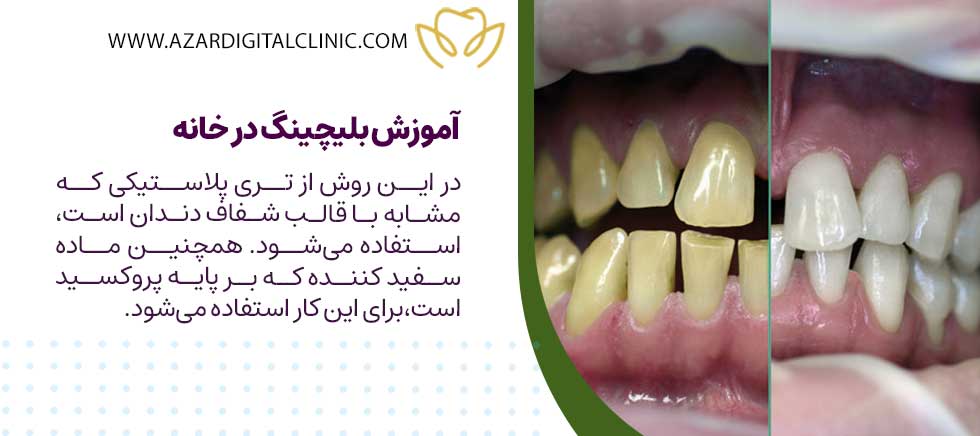 آموزش بلیچینگ در خانه