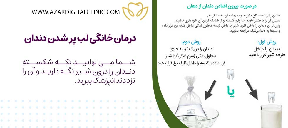 درمان خانگی لب پر شدن دندان
