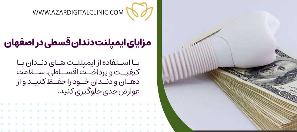 ایمپلنت دندان قسطی در اصفهان چه مزایایی دارد؟