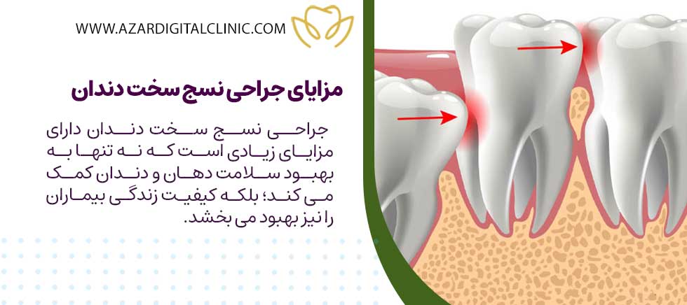مزایای جراحی نسج سخت دندان