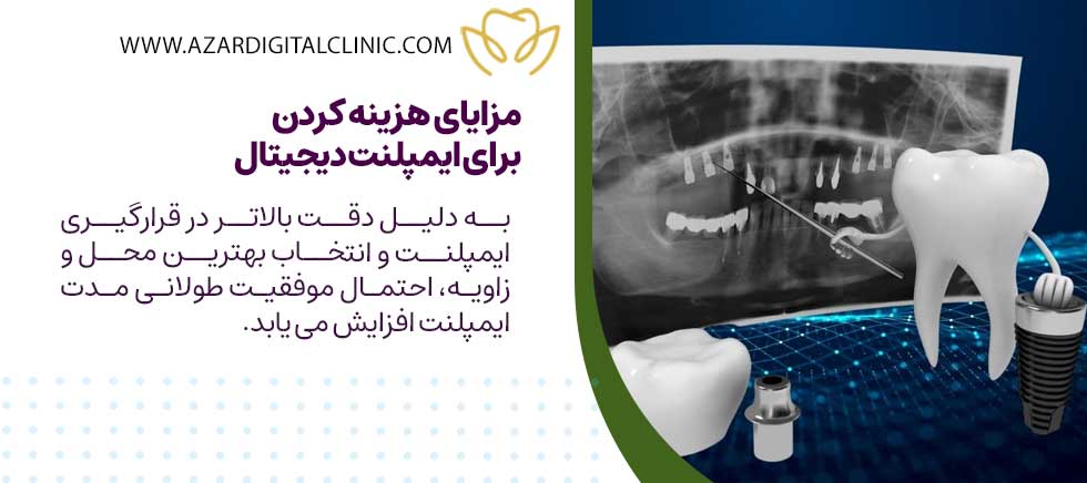 مزایای هزینه کردن برای ایمپلنت دیجیتال چیست؟