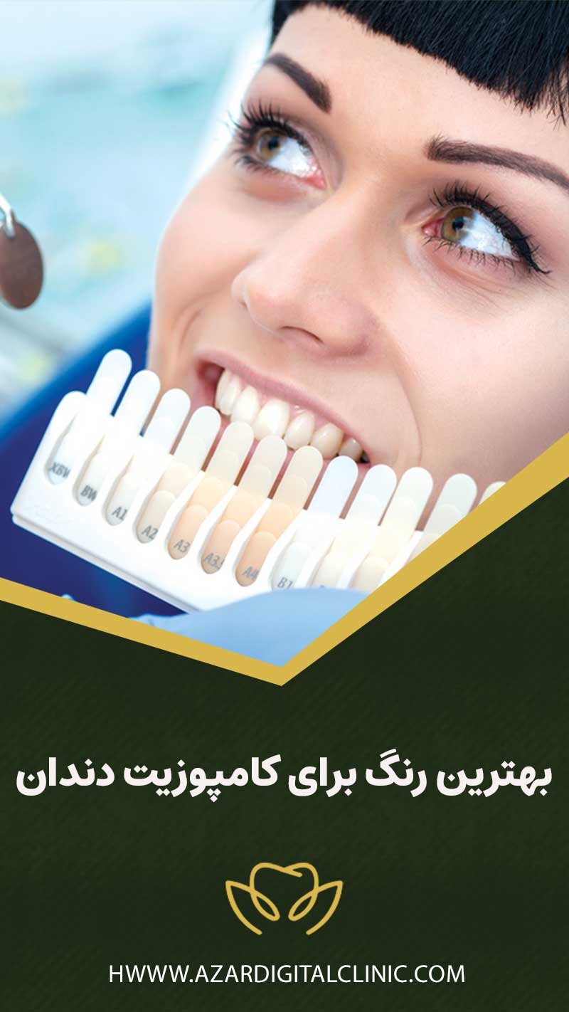 بهترین رنگ برای کامپوزیت دندان