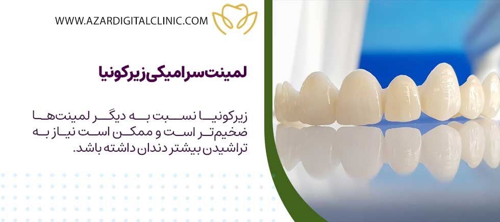 انواع لمینت سرامیکی دندان
