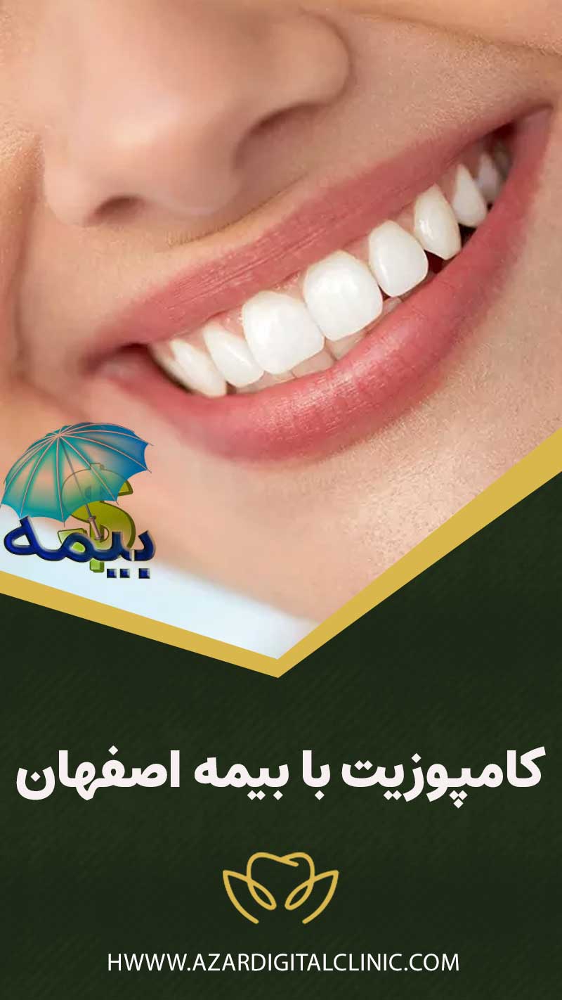 کامپوزیت با بیمه اصفهان
