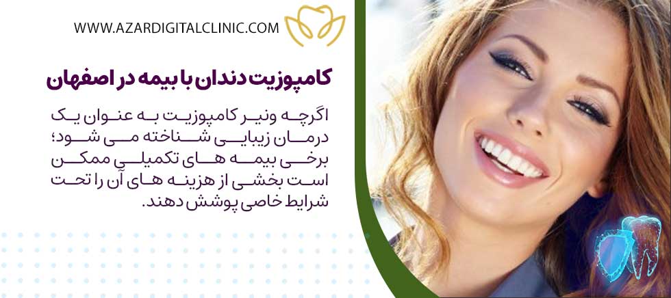 ونیر کامپوزیت دندان با بیمه در اصفهان