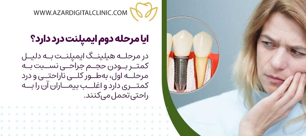 ایا مرحله دوم ایمپلنت درد دارد؟ (هیلینگ ایمپلنت درد دارد؟)