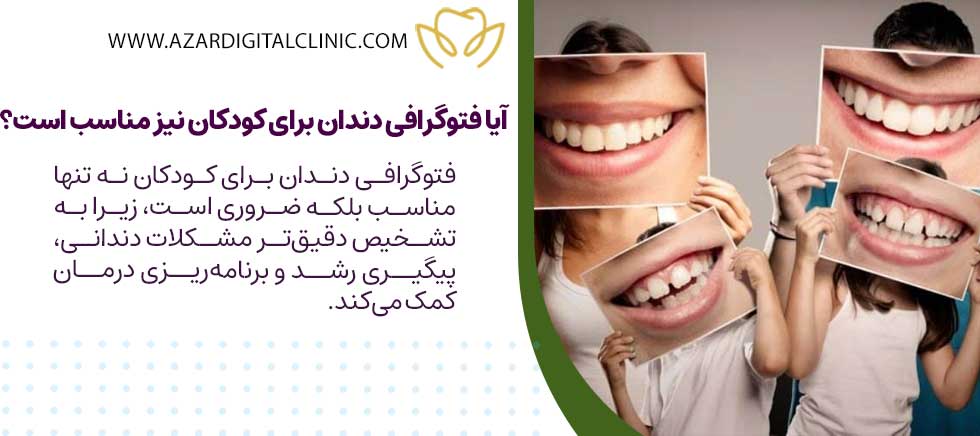 آیا فتوگرافی دندان برای کودکان نیز مناسب است؟
