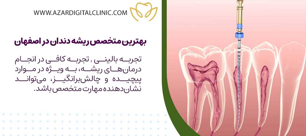 بهترین متخصص ریشه دندان در اصفهان چه ویژگی هایی دارد؟