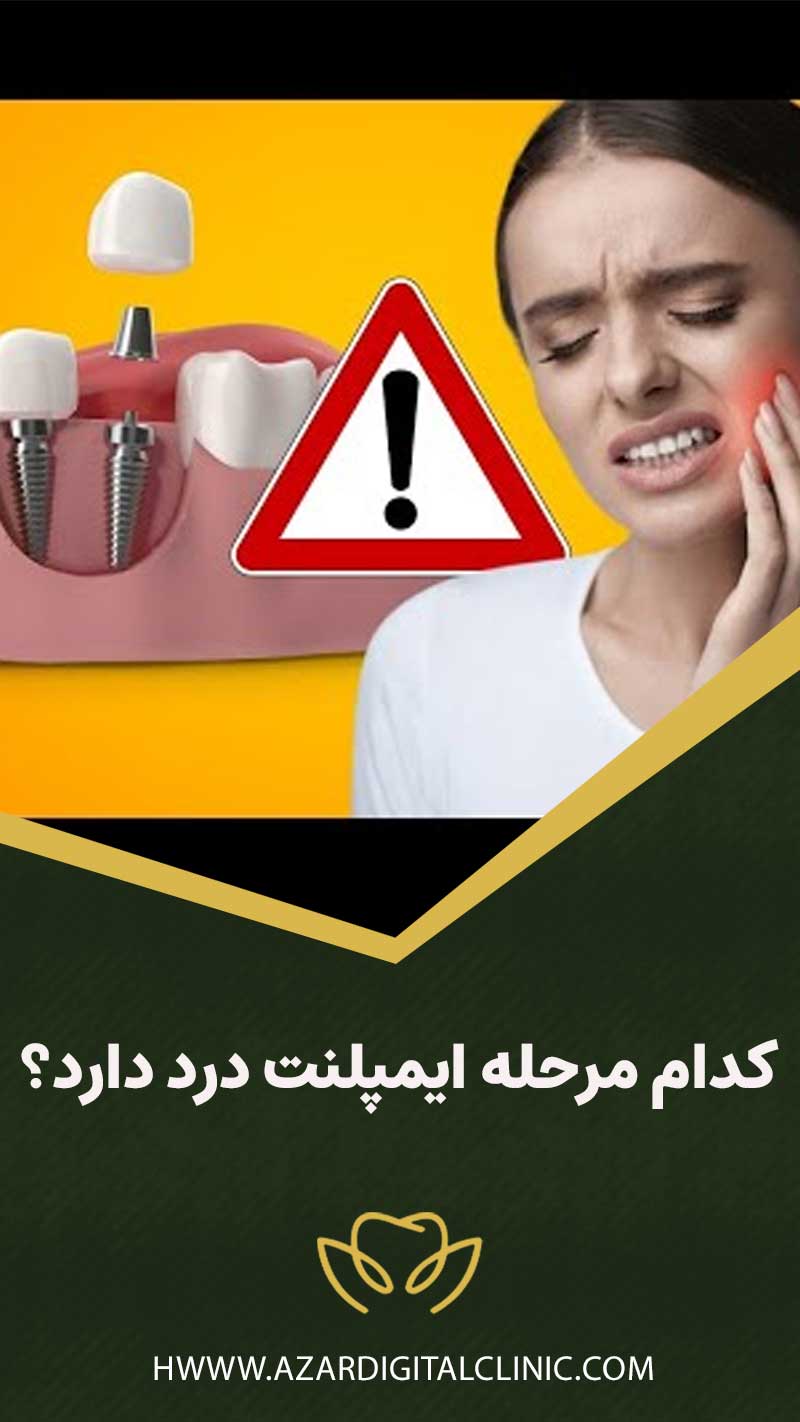 کدام مرحله ایمپلنت درد دارد؟