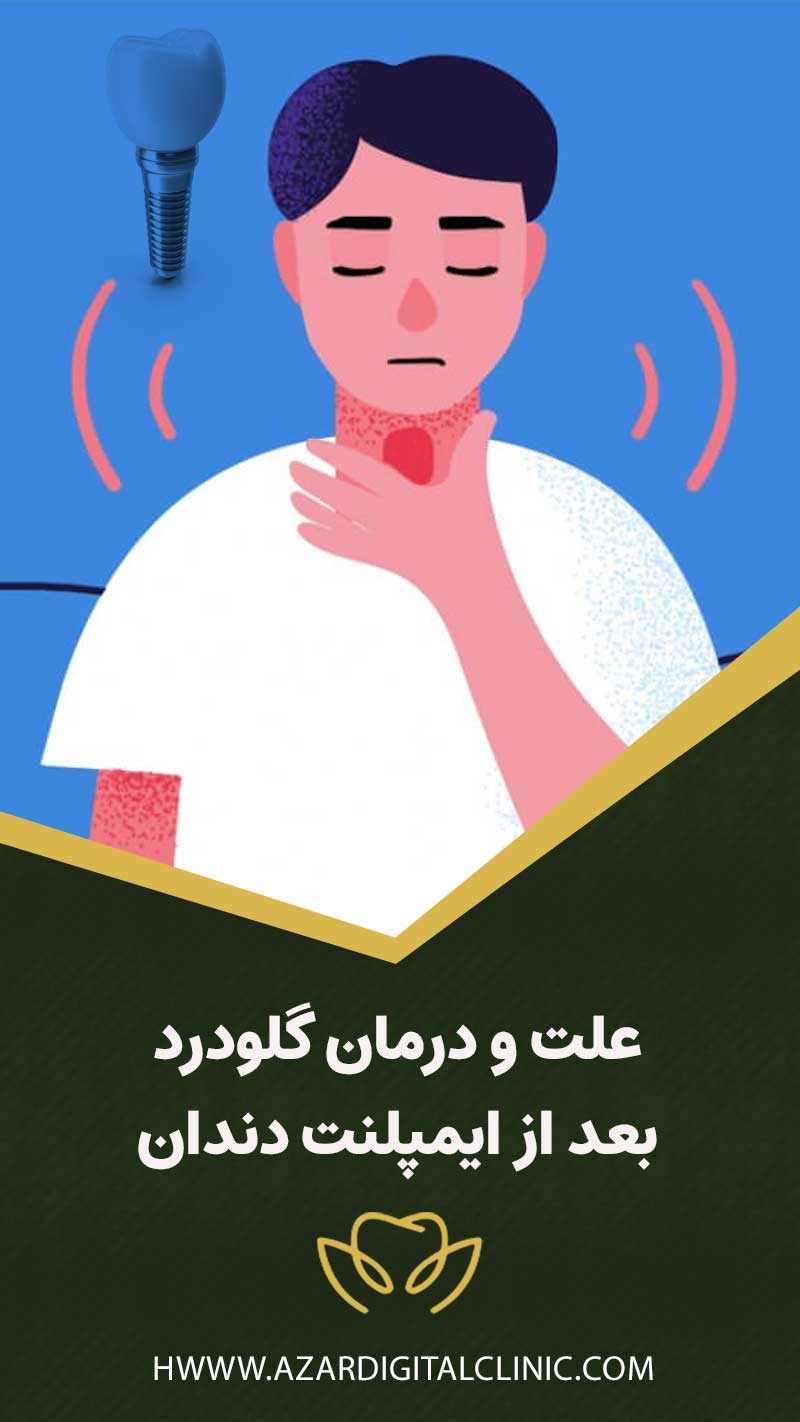 علت و درمان گلودرد بعد از ایمپلنت دندان