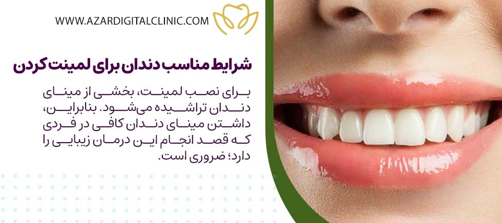 شرایط مناسب دندان برای لمینت