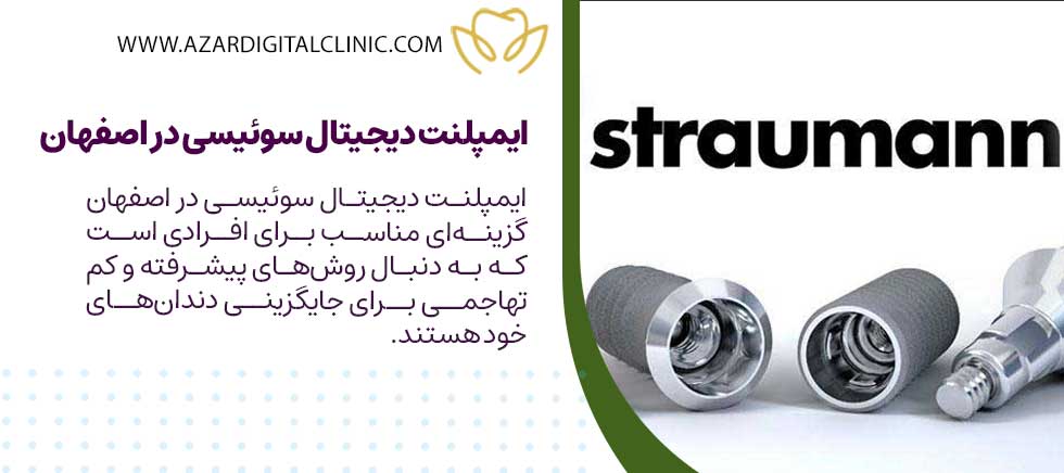 ایمپلنت دیجیتال سوئیسی در اصفهان