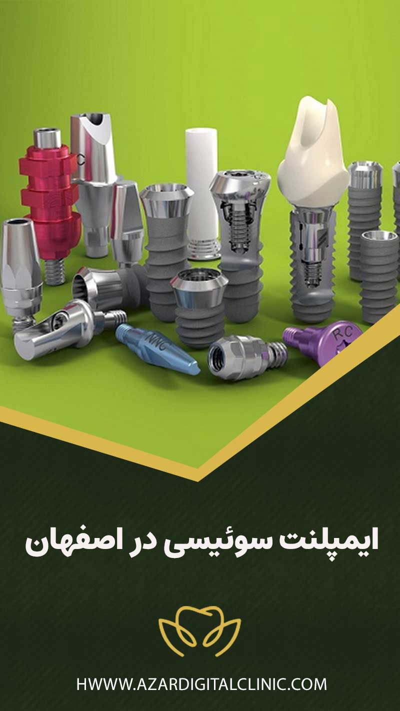 ایمپلنت سوئیسی در اصفهان