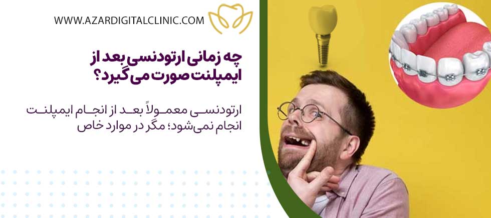 چه زمانی ارتودنسی بعد از انجام ایمپلنت صورت می گیرد؟
