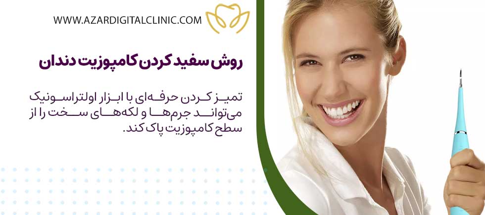 روش سفيد كردن كامپوزيت دندان