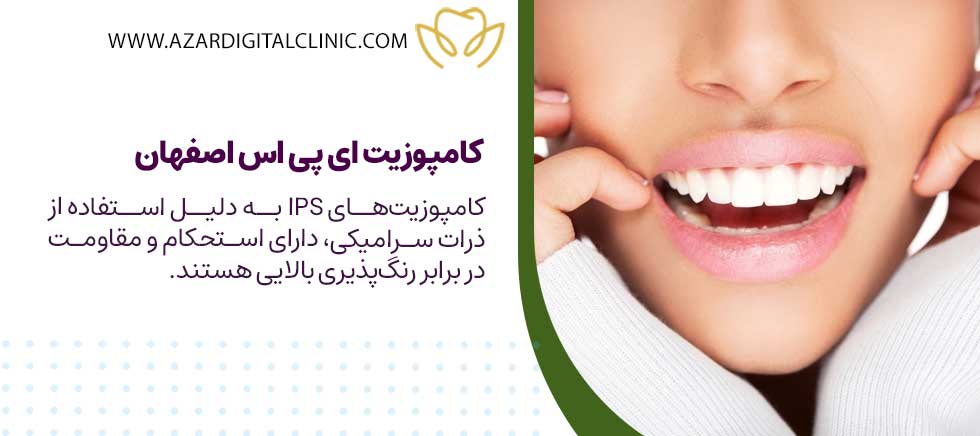 کامپوزیت ای پی اس اصفهان