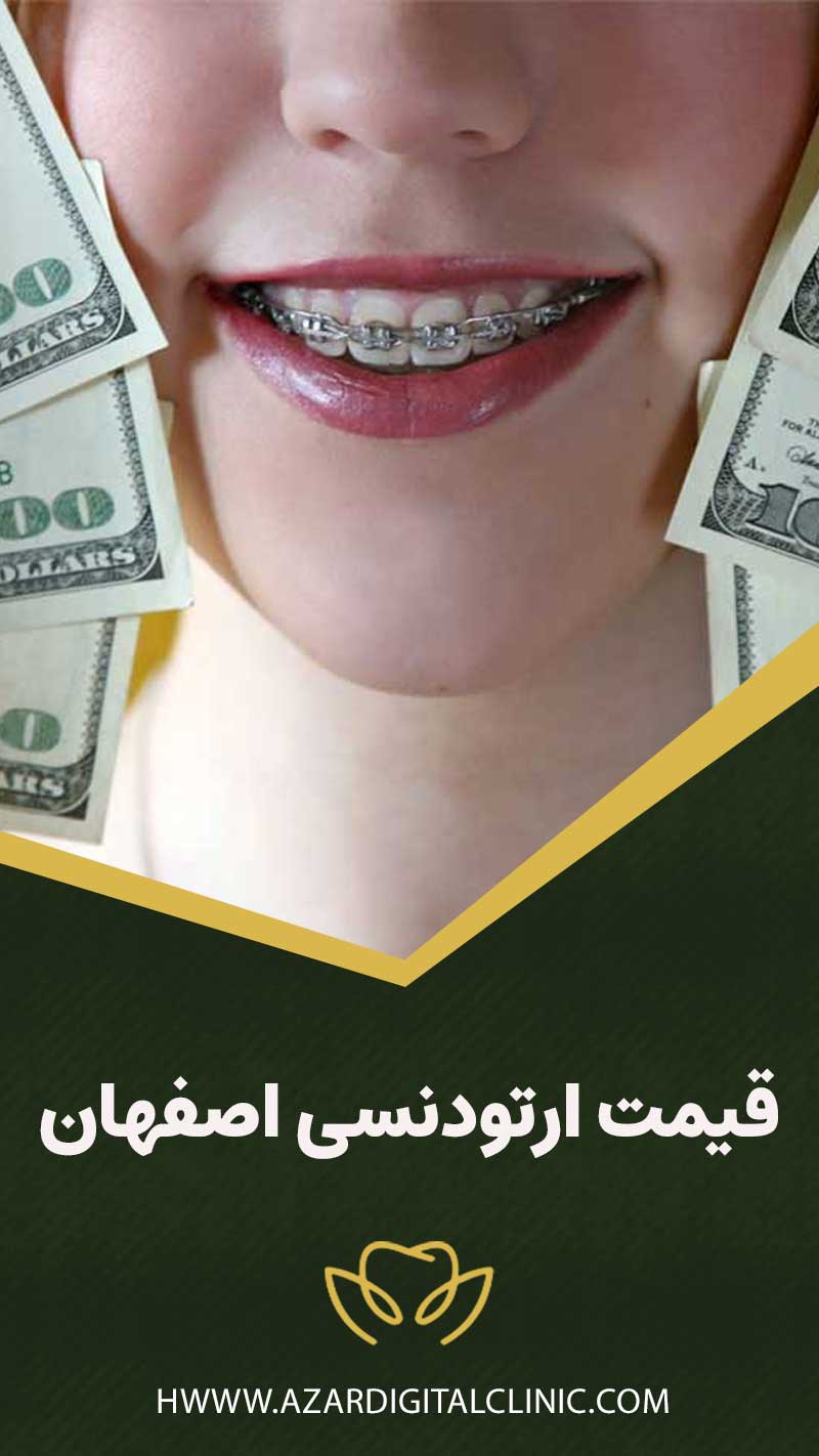 قیمت ارتودنسی اصفهان