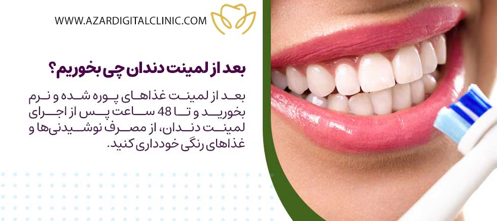 بعد از لمینت دندان چی بخوریم؟