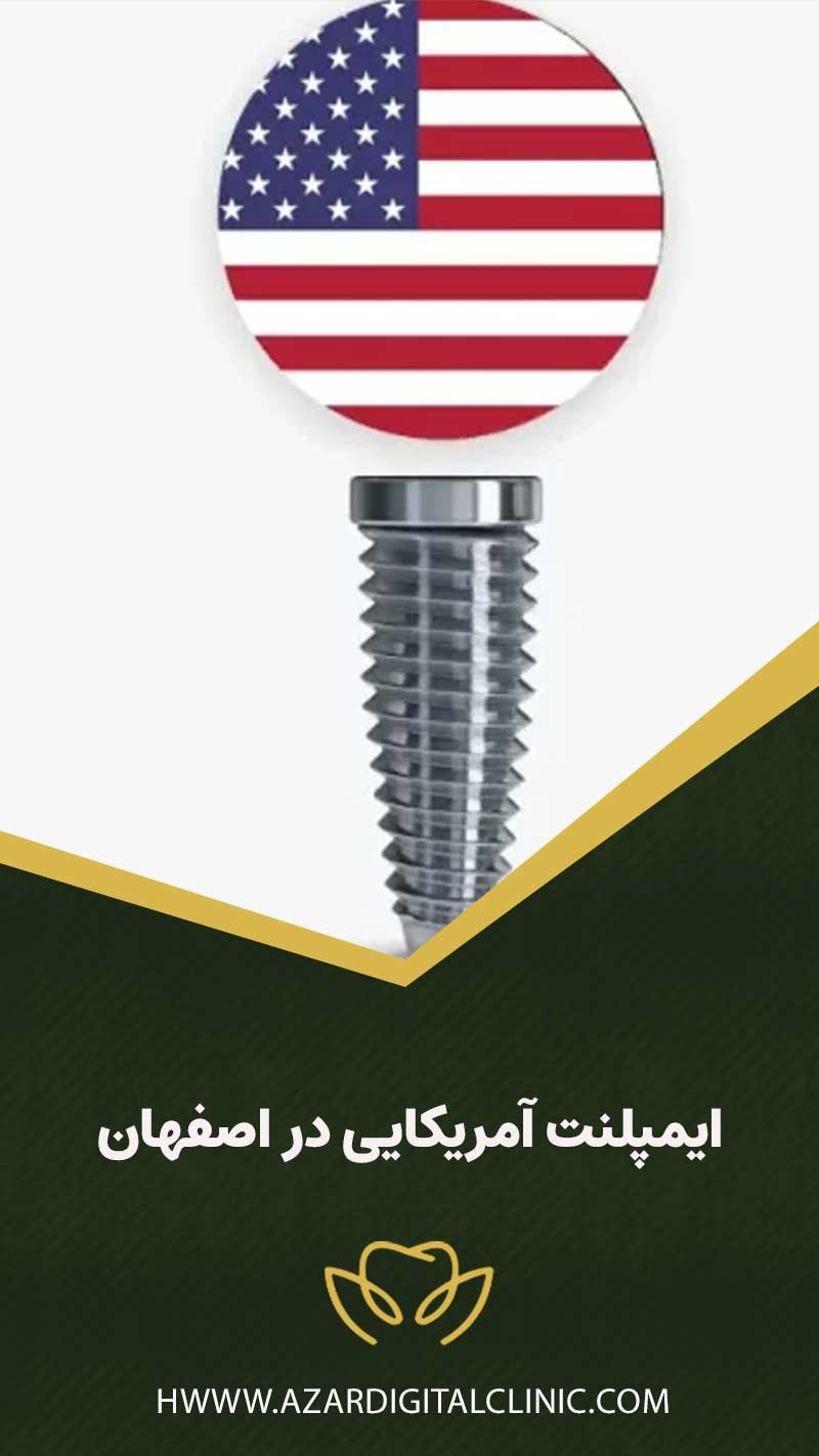 ایمپلنت آمریکایی در اصفهان