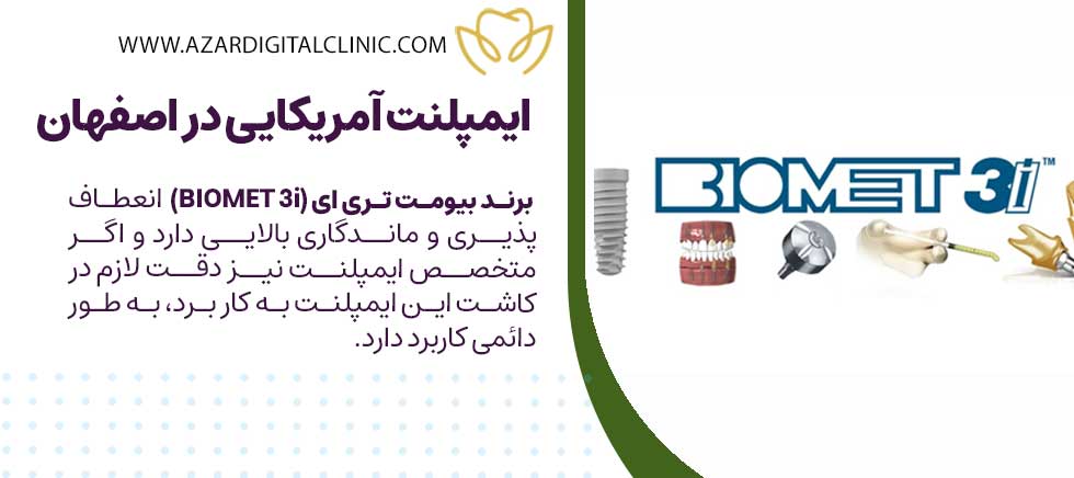 بهترین برندهای ایمپلنت آمریکایی در اصفهان کدامند؟