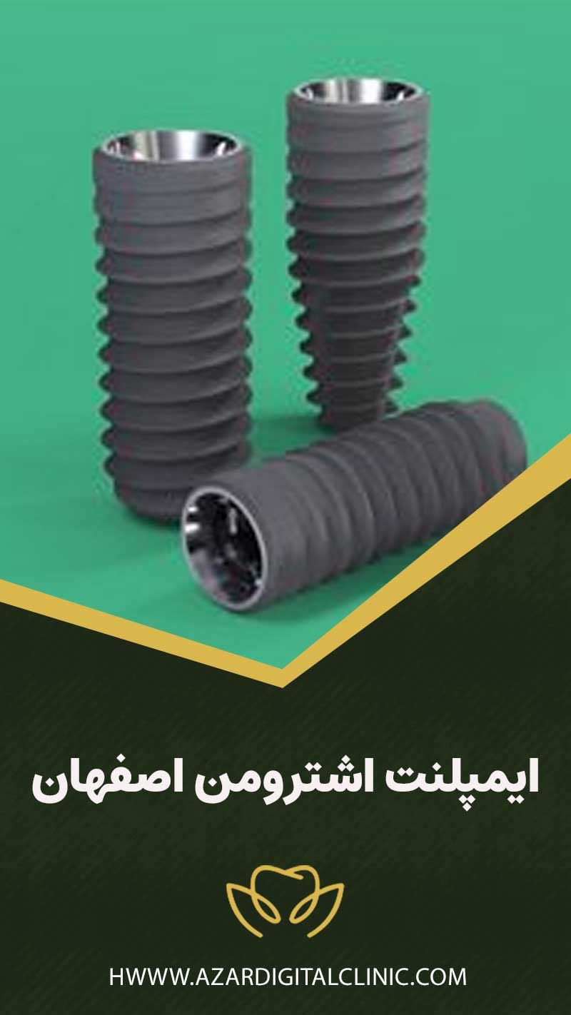 ایمپلنت اشترومن اصفهان